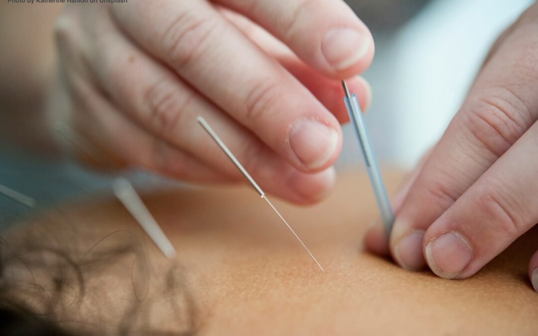 What is acupuncture?